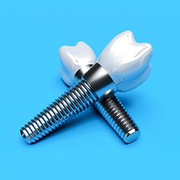 two dental implant posts with abutments and crowns