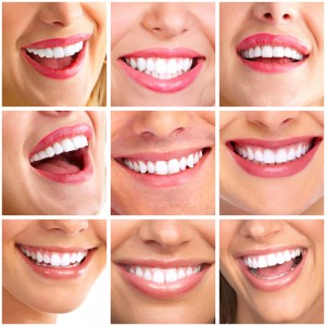 Tired of products that do nothing to brighten your smile? Try professional teeth whitening from Concord, NH dentists at Generations Dental Care.