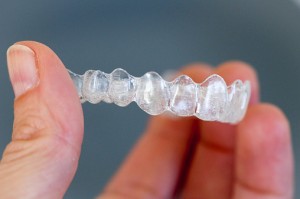 Thinkstock Invisalign